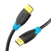 Cablu HDMI 2.0 Vention AACBE, 4K 60Hz, 0,75m (negru)