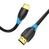 Cablu HDMI 2.0 Vention AACBF, 4K 60Hz, 1m (negru)