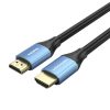 Cablu HDMI 2.0 Vention ALHSE, 0,75m, 4K 60Hz, 30AWG (albastru)